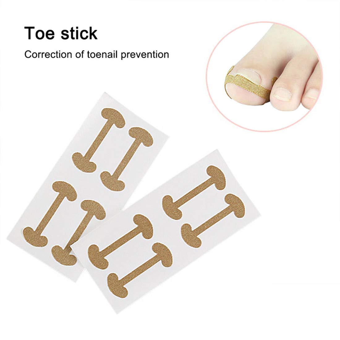 20 Pcs Ingrown Toenail Corrector Stickers, Toe Nail Treatment Elastic Patch Sticker Corrector Pedicure Tools Fingernail Toe Nail Care Protects Toe Nail: Beauty