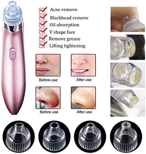 XIAXIA 2019 UPGRADE VERSION Blackhead Remover Vacuum Suction Facial Pore Cleaner Electric Acne Comedone Extractor Kit with 4 Microcrystalline Head for Women and Men Black Heads Extraction