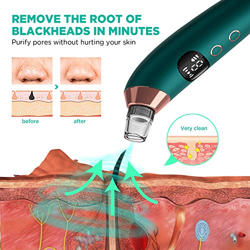 Cahot Blackhead Remover Pore Vacuum, Electric Blackhead Vacuum Pore
