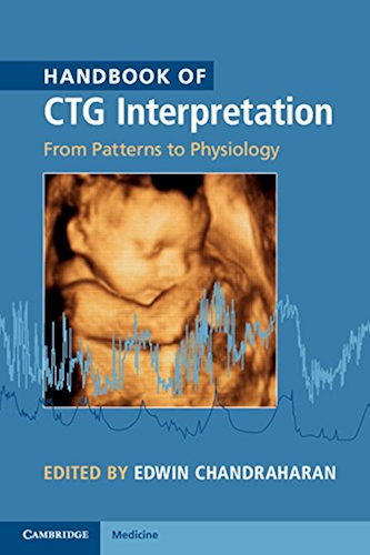 Download Handbook of CTG Interpretation: From Patterns to Physiology (English Edition) PDF