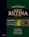 Ryan's Retina E-Book