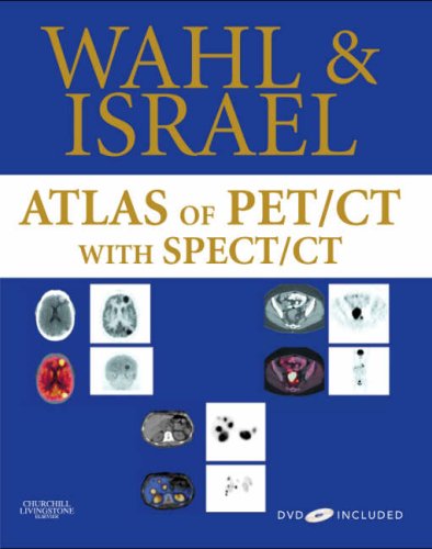 Atlas of PET/CT with SPECT / CT with DVD: 9781416033615: Medicine ...
