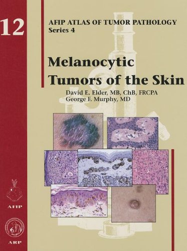 Melanocytic Tumors of the Skin (AFIP Atlas of Tumor Pathology: Series 4)