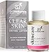 ArtNaturals Clear Skin Drying Lotion - (1 Fl Oz / 30ml) - Blemish Spot Remover Treatment for Fast Drying - Shrinks Whiteheads and Fades Out Face Blemishes