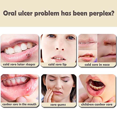 Infrared Red Light Therapy Device, Cold Sore Fever Blister Treatment Healing Pain Relief for Lips Mouth Nose Ear, Handheld Red Light Therapy for Body