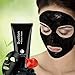 ROPALIA Activated Carbon Blackhead Remover Cream Deep Clean Purifying Peel Acne Mud Face Mask