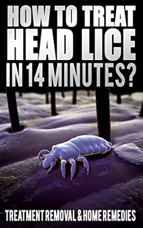 How To Treat Head Lice In 14 Minutes Treatment Removal Home