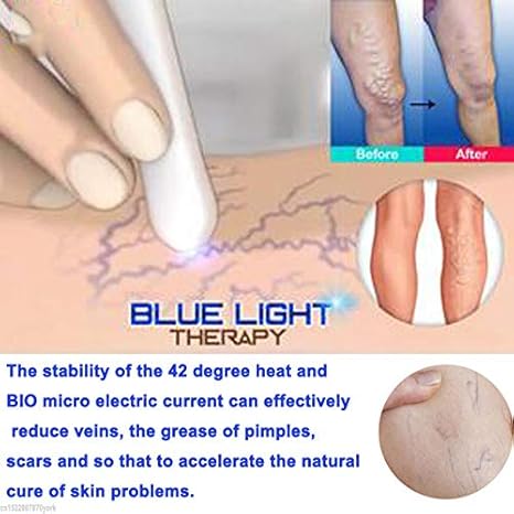 Amazon Com Laser Pen Scars Spots Removal Pro