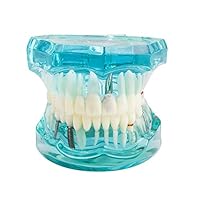 vinmax Dental Teeth Model,Transparent Dental Implant Disease Teeth Model Dentist Standard Pathological Removable Tooth Teaching Tools for Student (Pathological Teeth Model)