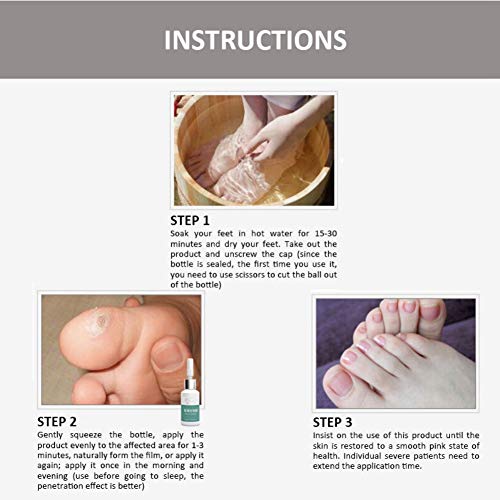 Corn Remover, Callus and Corn Remover Liquid, Foot Hand Care
