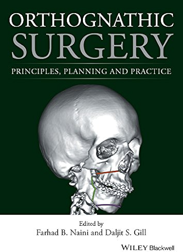 Download Orthognathic Surgery: Principles, Planning and Practice (English Edition) PDF