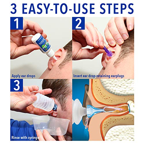 Mack's ProRinse Earwax Removal System - 0.5 FL OZ Ear Drops, Ear Plugs, Ear Wash Tub & Ear Syringe with Triple-Action Rinse Tip