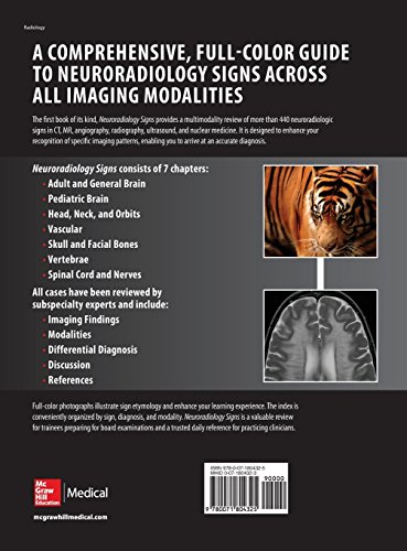 Neuroradiology Signs - //medicalbooks.filipinodoctors.org
