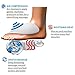 Shiatsu Electric Foot Massager, Sotion Massage Machine with Heat Function, Adjustable Intensity, Air Pressure, Deep 3D Kneading Rolling Vibration Relieves Plantar Fasciitis