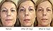 RejuveMD Growth Factor Anti-Aging Face Serum, 1.7 Fl oz