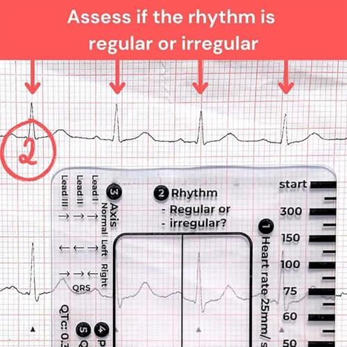 Transparent Ecg Ruler/Card, Transparent Ecg Ruler Card, Ecg/Ekgs Made Easy By Following A 7 Step Plan, Ekg Calipers Measuring Tool, Ideal For Students, Paramedics, Emt'S, Nurses 1PC (A)