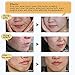 2 Pack TCM Scar and Acne Marks Removal Gel Ointment, Skin Repair Scars Burns Cuts Pregnancy Stretch Marks Acne Spots Skin Redness Treatment Cream for Face and Body (3 Pack)