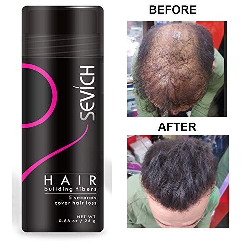 Economy Keratin Hair Building Fibers Instantly Thickens Thinning or Balding Hair for Men and Women - Natural Hair Loss Concealer 0.87oz (Medium Brown) - Thumbnail 4