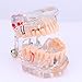 Tooth Model, Disease Teaching Study Adult Typodont Demonstration Teeth Model New