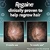 Regaine-for-Men-Hair-Loss-Regrowth-Scalp-Foam-Treatment-with-Minoxidil-73-ml-1-Month-Supply Regaine for Men Hair Loss & Regrowth Scalp Foam Treatment with Minoxidil, 73 ml, 1 Month Supply
