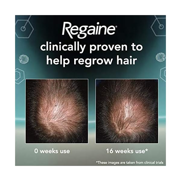 Regaine-for-Men-Hair-Loss-Regrowth-Scalp-Foam-Treatment-with-Minoxidil-73-ml-1-Month-Supply Regaine for Men Hair Loss & Regrowth Scalp Foam Treatment with Minoxidil, 73 ml, 1 Month Supply