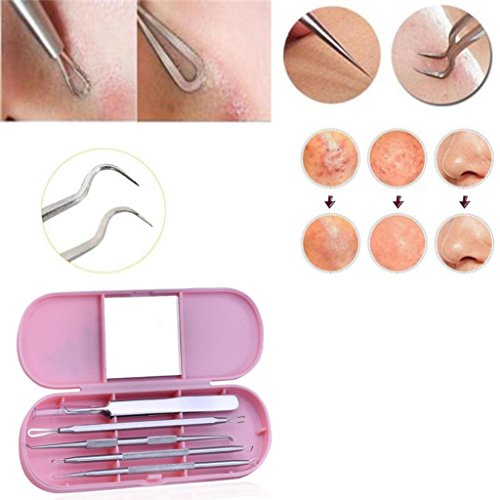 Veepola Stainless Curved Facial Acne Spot Pimple Remover Extractor Tool Comedone Remover Tewezers Face Care Set