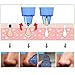 Beautural Blackhead Remover Vacuum Suction Pore Cleanser, FDA Approved USB Rechargeable Electric Beauty Device Acne Treatment Comedones Removal Tool Pimple Extractor Microdermabrasion Exfoliating