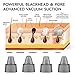BLACK VAC Pore Vacuum & Blackhead Remover Vacuum (2019 Edition) | Skin Vacuum Cleaner for Nose, Forehead, Facial Cleaning Tool for Pimples, Whiteheads, Acne | Comedone Extractor with Dermasuction Cl