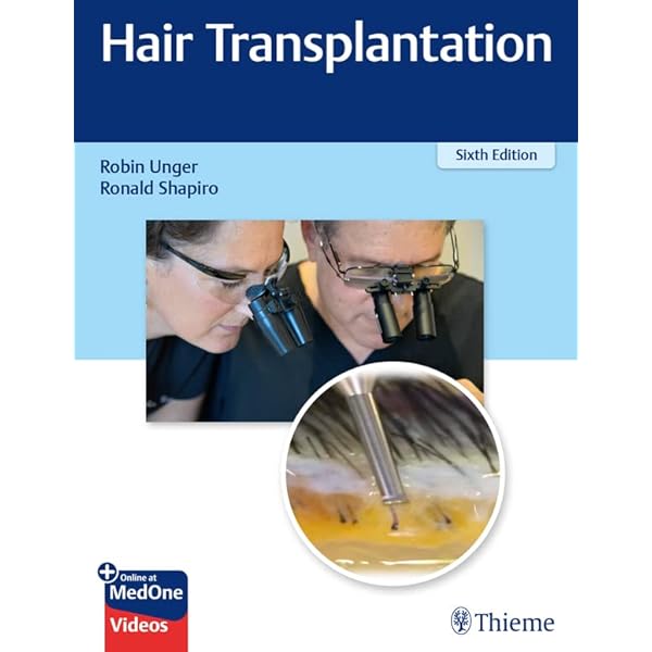 Amazon.com: Practical Guide to Hair Transplantation