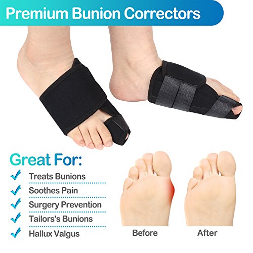 Bunion Corrector, 9 pcs Bunion Corrector and Bunion Relief, Bunion Night Splint with Super Soft Gel for Foot Pain Relief, Hallux Valgus Splint Aid Surgery Treatment Toe Separators Straighteners - Thumbnail 3