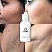 Body Hair Growth Inhibitor Repair Fluid After Hair Removal Best gift for Women and Men(1pcs)