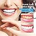 VieBeauti Teeth Whitening Accelerator Light, 5x More Powerful Blue LED Light, Speed Up Whitening Process For a Quicker Whiter Smile