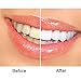 Activated Charcoal Powder 100% from USA Trees - Raw Organic Coconut Charcoal Food Grade – for Natural Teeth Whitening, Ultra Cleansing Face Mask, Zit Spot Treatment, and Bug Bite Be-Gone