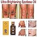 Ultra Brightening Spotless Oil Wishwin 30ml Skin Care Natural Essential Oil Dark Spots Removal Age Spots Brightening Skin Essence