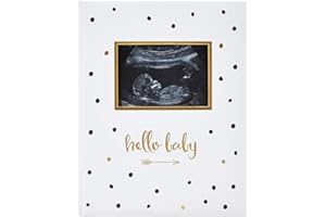Pear Head Sonogram Baby Memory Book, Black and Gold Polka Dot (72028)