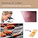 Wart Remover, Wart Removal Plasters Pad, Foot Corn Removal Plaster with Hole, Feet Callus Remove, Soften Skin Cutin Sticker Cure Toe Protector, Relief Pain Removal Warts Plaster 24 Pcs/Boxthumb 2