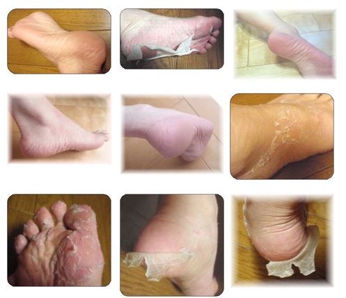 baby foot amazon