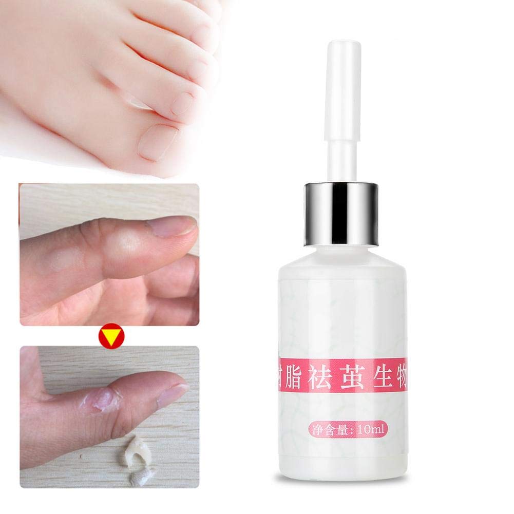 hard skin on toe removal