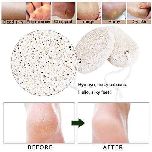 Natural Pumice Stone for Feet Callus (2 PCS), Pinowu Lava Pedicure Tools Hard Skin Callus Remover for Feet and Hands - Foot Scrub Natural Foot File Exfoliation to Remove Dead Skin