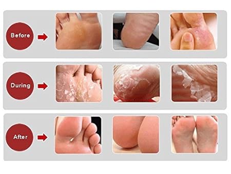 baby foot amazon