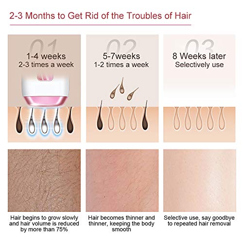 Hair Removal For Women, IPL Laser Hair Removal Permanent 999,999 Flashes Upgraded Hair Remover Device Painless on Facial Body Bikini line Legs Arms Armpits for Women And Men Wholebody Home Use