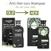 Anti-Hair Loss Shampoo For Men & Women, LuckyFine – Contains Herbal Ingredients, Helps Stop Hair Loss, Hair Growth, Stimulates Hair Re-growth Dandruff Treatment 200ML