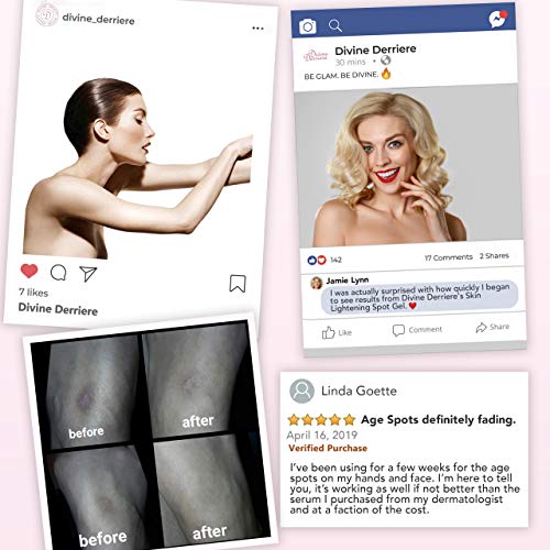 Divine Derriere Skin Lightening 2 Hydroquinone Bleaching Cream with 6