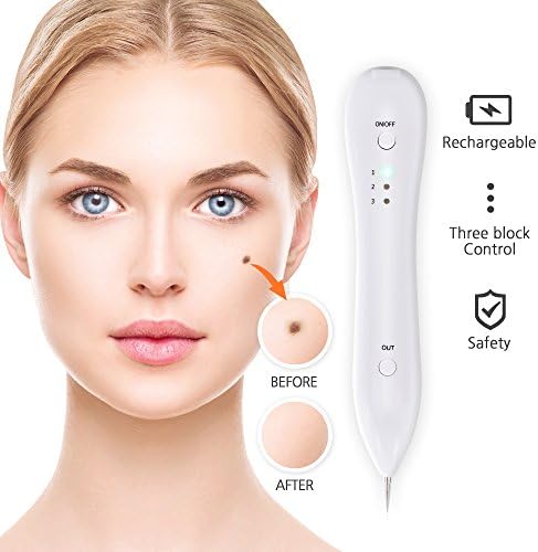 Mole Removal Pen USB Rechargeable Portable Skin Tag Removal Pen No bleeding Set For Body Facial Freckle Nevus Warts Age Spot Tattoo, Dark Spot, Birth Mark By Elobara (white)
