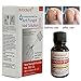 BUOCEANS Fungus Stop, Fungal Nail Oil, Anti Fungus Nail Treatment, Effective Against Nail Fungus, Anti fungal Nail Solution, Toenails & Fingernails Solution, Restores Toenail Fungus, Clear, 25 ml