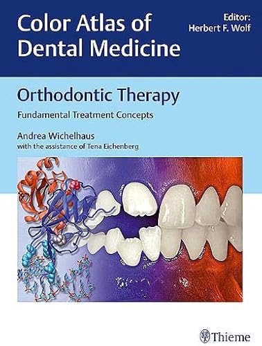 Download Orthodontic Therapy: Fundamental Treatment Concepts PDF