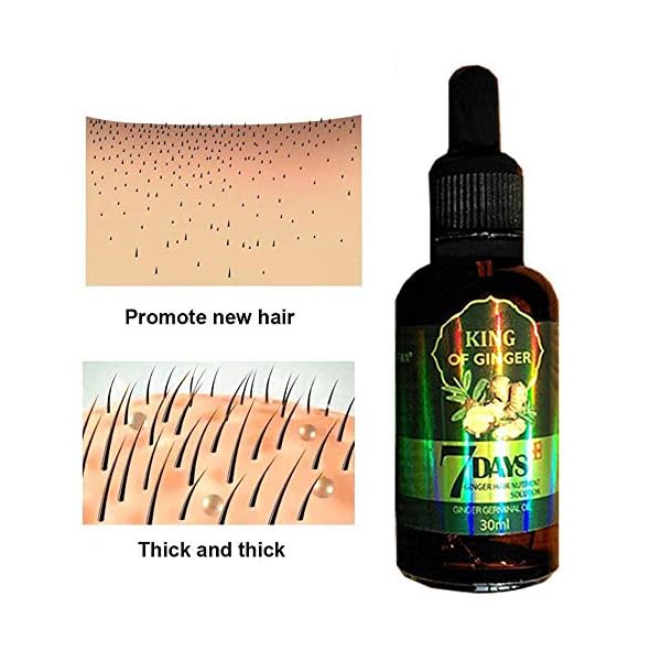 Hair Growth Serum, Hair Care Product, Hair Serum, Fast Hair Growth, Hair Growth & Hair Thickening,Stop Hair Loss, Grow…