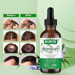 Hair Growth Serum, Rosemary Oil for Hair Growth
