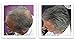 Hair Powder For Thinning Hair. Makes Thin Hair Look 10X Fuller, Covers Bald Spot Instantly. All-Natural Hair Building Fiber. Trial Size (10-Day Supply). Black