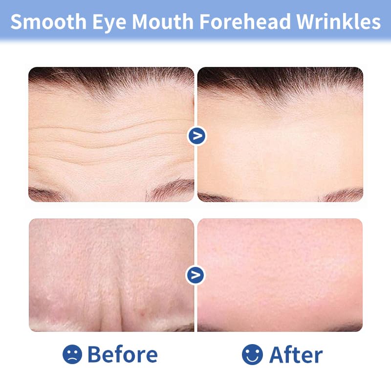 Medimama Collagen Forehead Wrinkle Patches, Anti-Wrinkle Collagen Patches with Seaweed Polysaccharide & Glycerin, Deep Hydration & Firming (1 Count (Pack of 10))